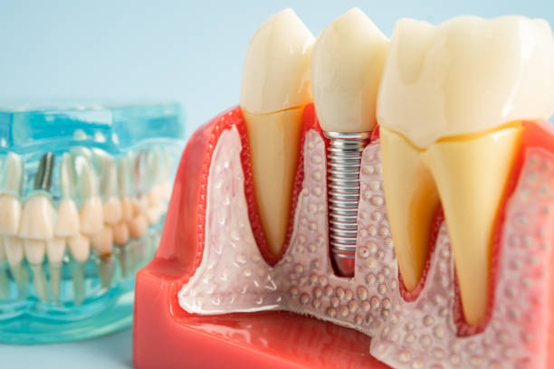 Best Emergency Dental Care  in Hemet, CA